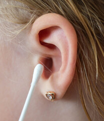 Cleaning a child's ear with a cotton swab from contamination of the ear drum and ear canal. Earwax...
