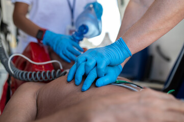 Paramedical staff performing the heart massage and oxygenation procedure - obrazy, fototapety, plakaty