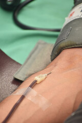 Injecting a needle to collect blood. A butterfly needle is a device used to access a vein for drawing blood or giving medications. Some medical professionals call a butterfly needle.
