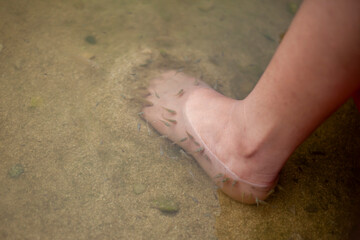 tadpoles nibbling on human foot
