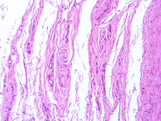 Histology of human tissue, show  epithelial tissue and connective tissue with microscope view  from...