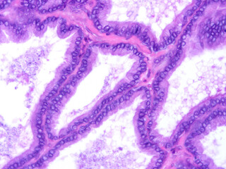 Histology of human tissue, show  epithelial tissue and connective tissue with microscope view  from laboratory (not Illustration Designation)