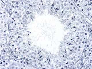 Histology of human tissue, show  epithelial tissue and connective tissue with microscope view  from laboratory (not Illustration Designation)