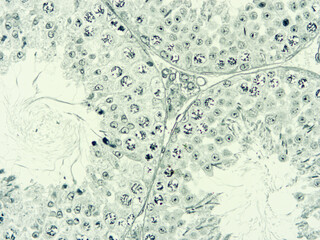 Histology of human tissue, show  epithelial tissue and connective tissue with microscope view  from...