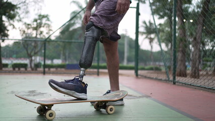 Skateboarder standing with his prosthetic leg. Disabled person with skateboard and artificial leg