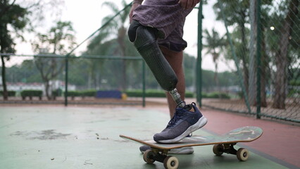 Skateboarder standing with his prosthetic leg. Disabled person with skateboard and artificial leg