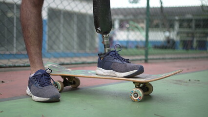 Closeup disabled person wearing prosthetic artificial leg standing on skateboard © Marco