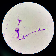 Budding yeast cells with pseudohyphae in urine sample on wright gimsa stain.