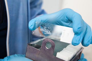 Scientist placing slides with paraffin embedded tissue samples into a slide staining rack....