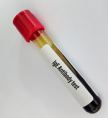 Blood sample for 
IgE antibody test. Allergy testing for detect allergen substance cause allergic reaction by measure IgE antibodies.