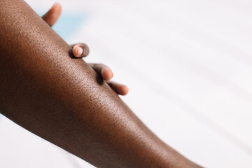 Bare legs of afro american woman closeup, blurred background free copy space. Black person lying...