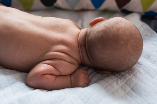 newborn backhead with birthmark