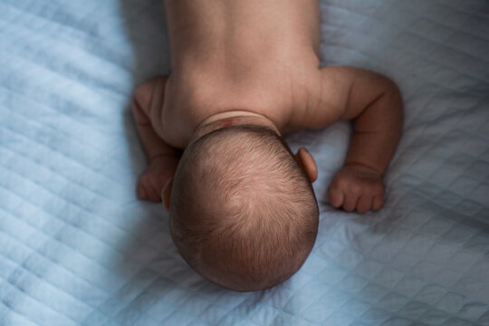 newborn backhead with birthmark