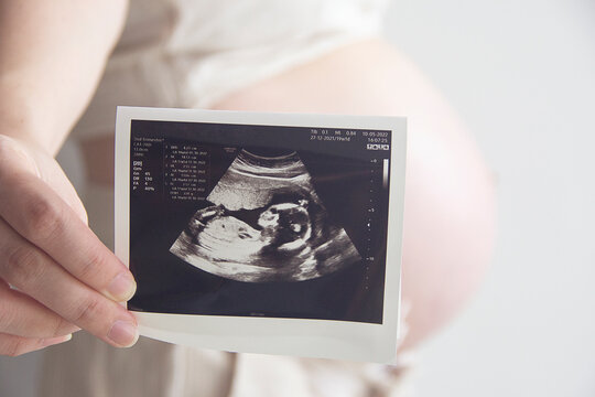 Pregnant woman holding ultrasound image. Concept of pregnancy, health care, gynecology, medicine. Young mother waiting for the baby. Close-up.