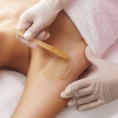 Hair removal, beauty and health concept. A young girl is getting an epilation procedure. A processional beauty worker is making depilation with hot wax.