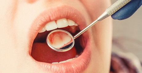 Girl having teeth examined at dentists. Woman in stomatology clinic with dentist. Healthy teeth concept