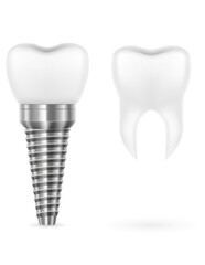 metal human tooth implant vector illustration