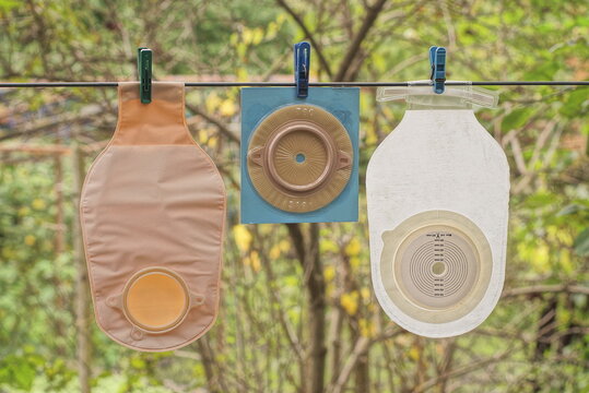 three different medical colostomy bags hang on a wire in the street among green vegetation