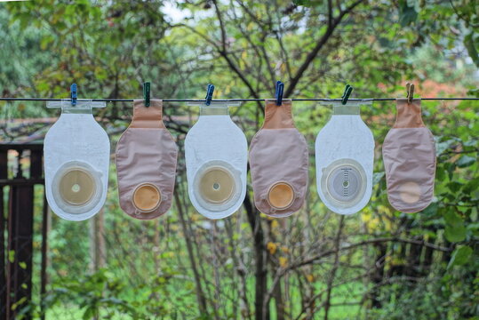 a row of brown white plastic medical colostomy bags hang on a wire on the street among green vegetation