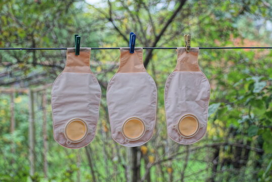 three brown plastic medical colostomy bag hangs on a wire in the street among green vegetation