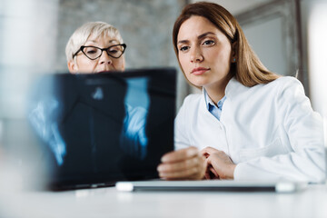 Two female doctors holding X-ray image and analyzing the results at clinic