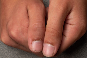 Dirty and long nails with burrs, fingers and fingernails of a child on a gray background.
