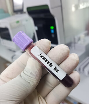 Blood sample for Zonisamide blood test, therapeutic drug monitoring, medical concepts.