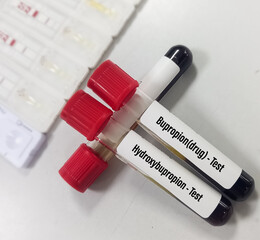 Blood sample for Bupropion(drug) and Hydroxybupropion test, to set therapeutic range antidepressant...