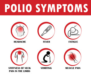 Polio symptoms, virus, poliomyelitis