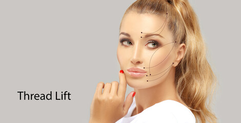 Thread Lift ,markup, thread-lift procedure for facial rejuvenation.