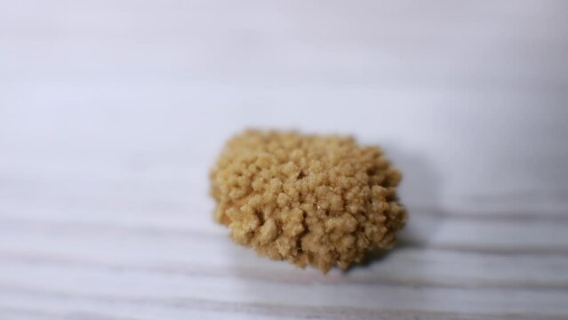 Close-up of a human kidney stone under magnifying glass. An oxalate stone extracted from a human kidney.