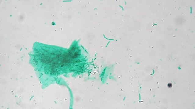 Macro footage of nostoc whole mount magnified in 200 times by microscope on bright field. Green cyanobacterium living in freshwater filmed under special lab equipment for the biological education.