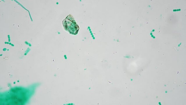 Macro footage of nostoc whole mount magnified in 400 times by microscope on bright field. Green cyanobacterium living in freshwater filmed under special lab equipment for the biological education.