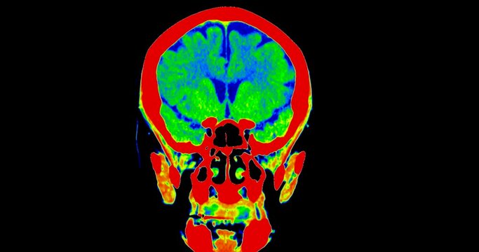 CT scan of the brain in colorful mode or PET CT Scan .