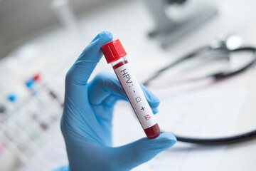 Laboratory - blood sample positive with HPV (human papilloma virus) deficiency test