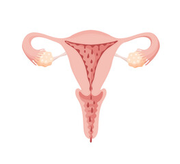 Menstruation in woman, illustration of uterus with blood drops for gynecology, woman health concept. Vector flat icon, female internal organs anatomy.