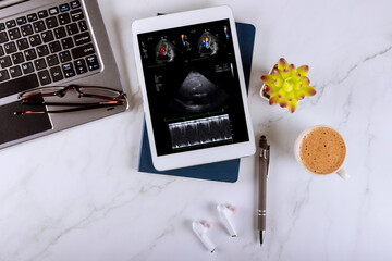 A doctor using a digital tablet examines the results echocardiography ultrasound of heart...