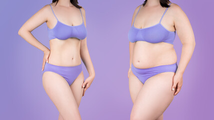 Tummy tuck, cellulite removal, woman's body before and after weight loss on purple background, plastic surgery concept - obrazy, fototapety, plakaty