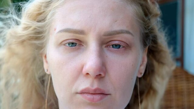 Portrait of tired sick woman with blue eyes looking into the camera. Woman has reddened eyelids and wet eyes. Girl looks tired and sad, going through grief.