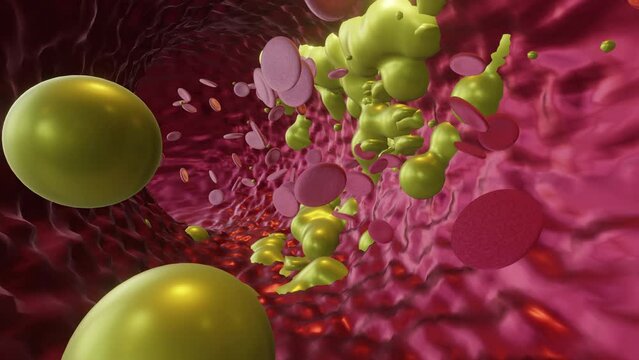 Cholesterol Buildup in Blood Vessel (Extreme Closeup)