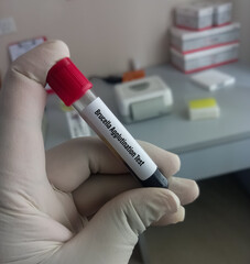 Obraz premium Blood sample for Brucella agglutination test to diagnosis of brucellosis.