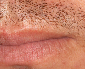 Hair on the skin of a man's face. Macro