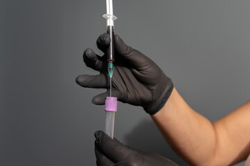 A close up of hands and blood draw process