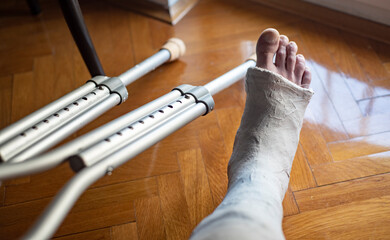 Broken leg in a plaster cast, near a crutches. Home rehabilitation after a broken leg