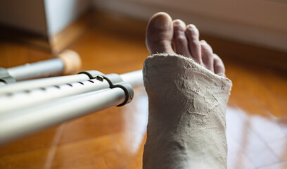 Broken leg in a plaster cast, near a crutches. Home rehabilitation after a broken leg