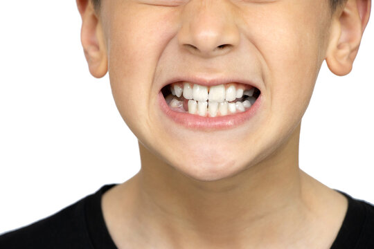 Oral health and hygiene. Boy grinding his teeth on a white background