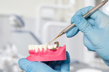 Dentist's hands with layout of the human jaw and dental restoration instrument.