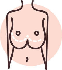 Breast reduction surgery, illustration, vector on white background.