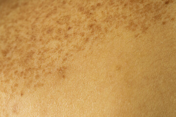 Texture of human skin as background, closeup view