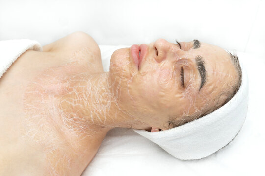 Dried enzyme mask on the face and neck of a woman. Rejuvenation and facelift in a cosmetology clinic. side view